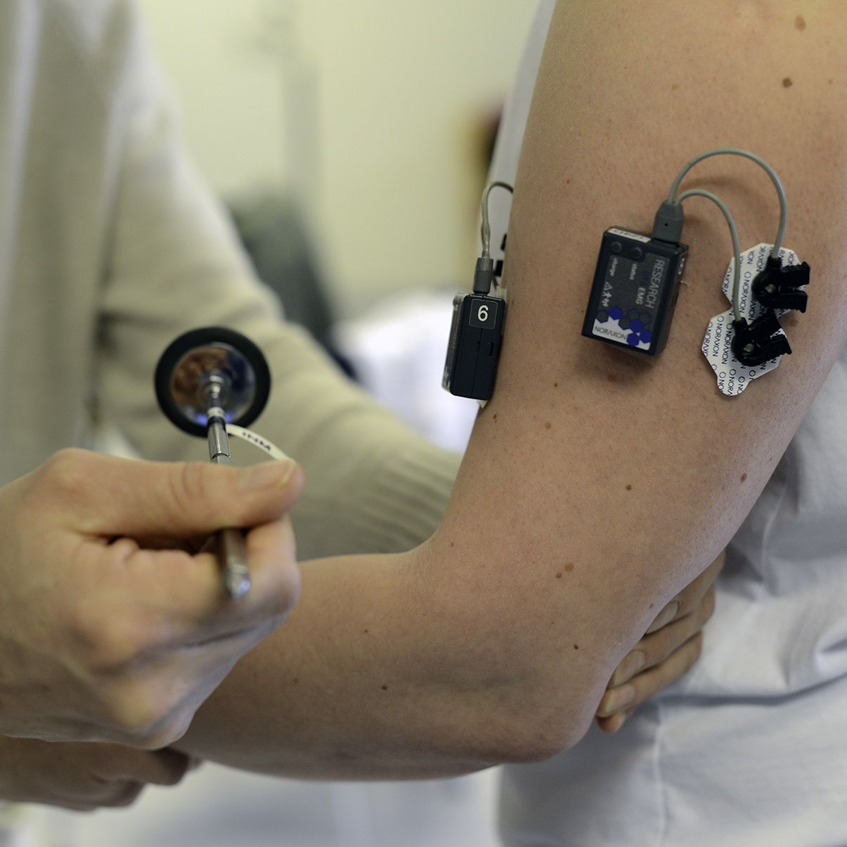 Forsker bruker reflekshammer på pasientarm med påmonterte sensorer.